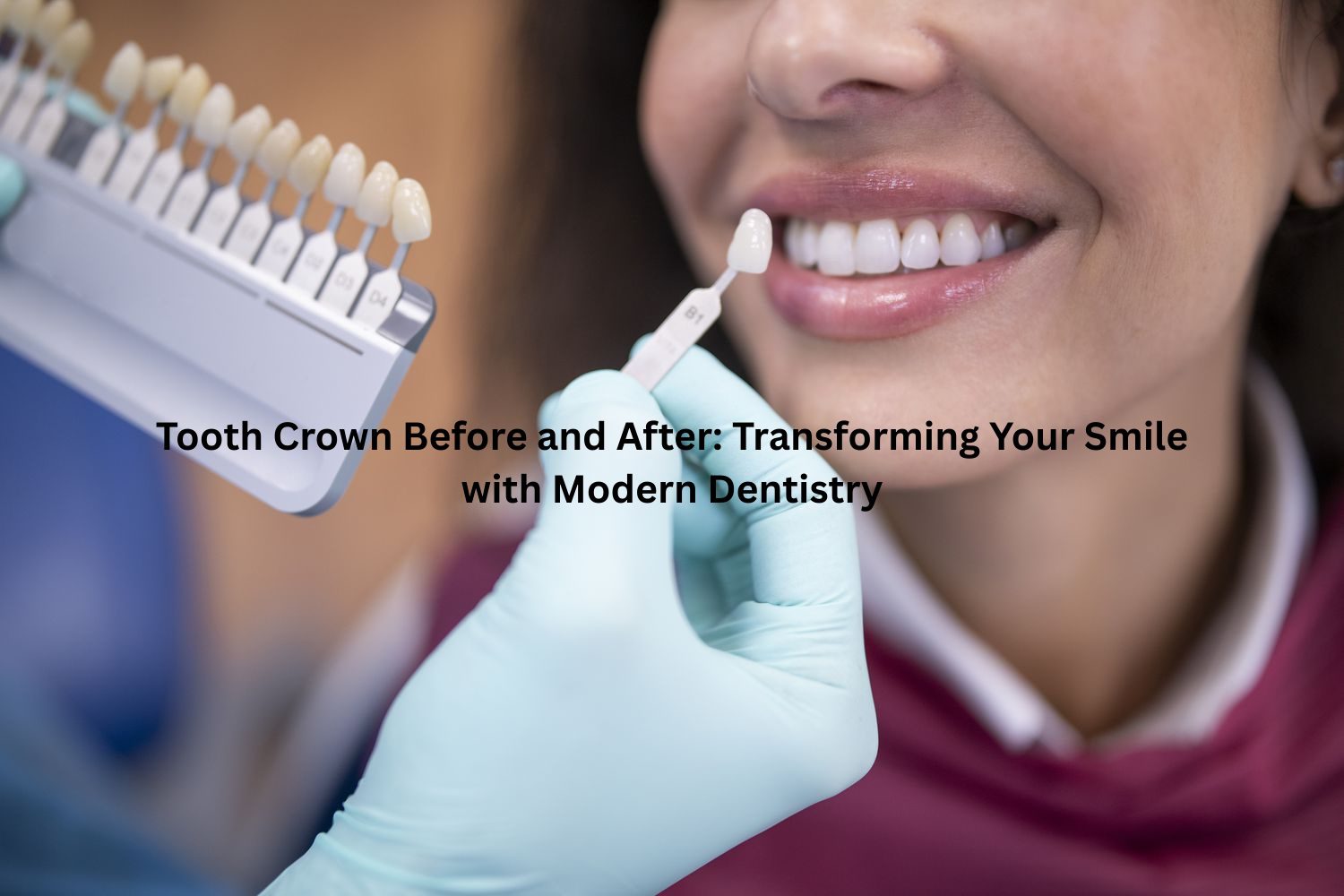 Tooth Crown Before and After